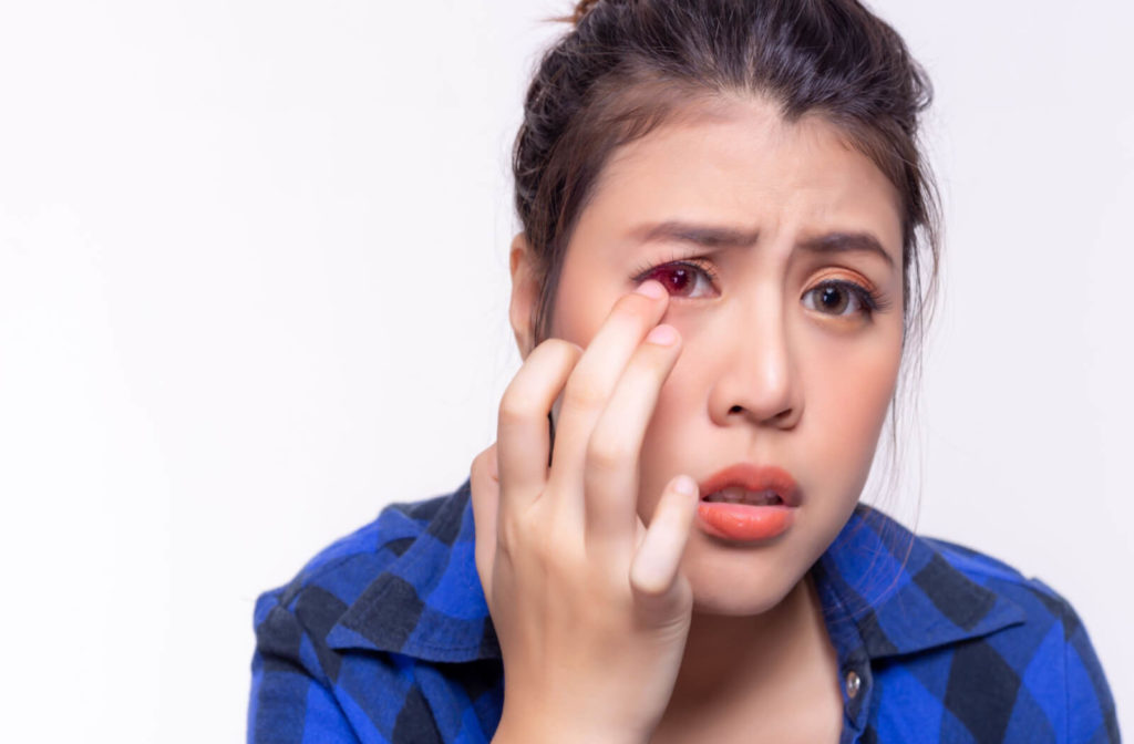 a woman with pink eye looks in pain as she tries to put in a contact lens